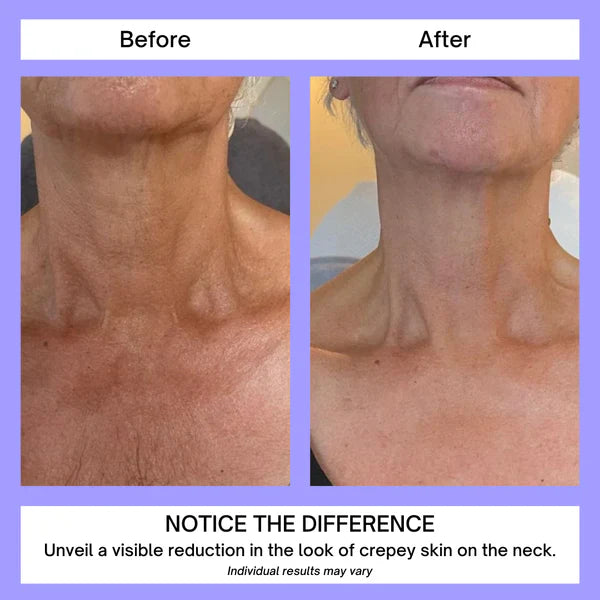 💜2x1 Neck Cream® Reafirmante Antienvejecimiento-Compra 1 y llévate 2💜