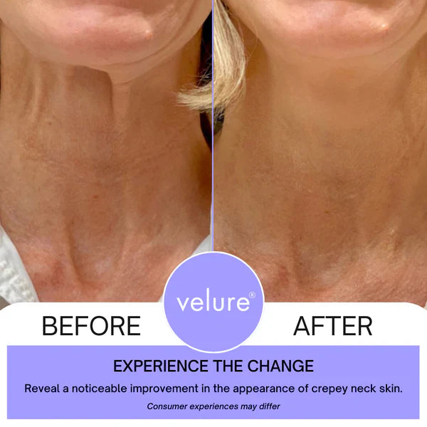 💜2x1 Neck Cream® Reafirmante Antienvejecimiento-Compra 1 y llévate 2💜
