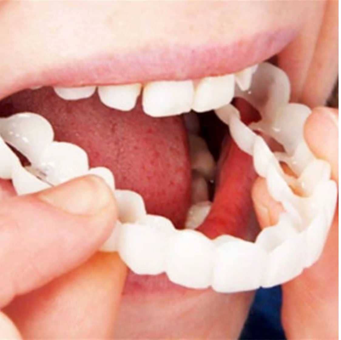 Smiley™ Molde de Sonrisa Perfecta Belleza, Salud, Aseo, Cuidado Personal Tienda Aparatto