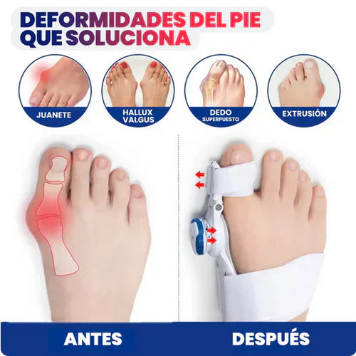 🔥 PROMO 2X1 CORRECTOR DE JUANETES - RESULTADOS EN UN MÊS 🦴