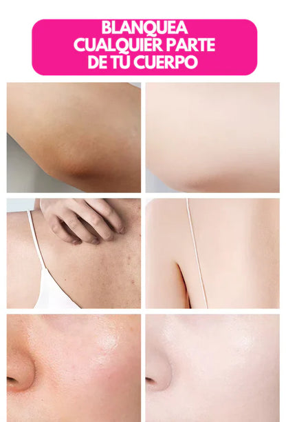 PROMO- 2Unds Crema Blanqueadora® Aclarante Piel y Más!!