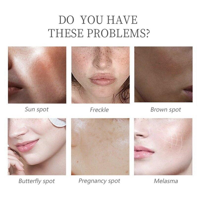 Serum Facial Aclarante Kojic Acid💧🌟