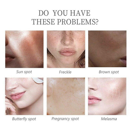 Serum Facial Aclarante Kojic Acid💧🌟