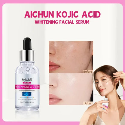 Serum Facial Aclarante Kojic Acid💧🌟